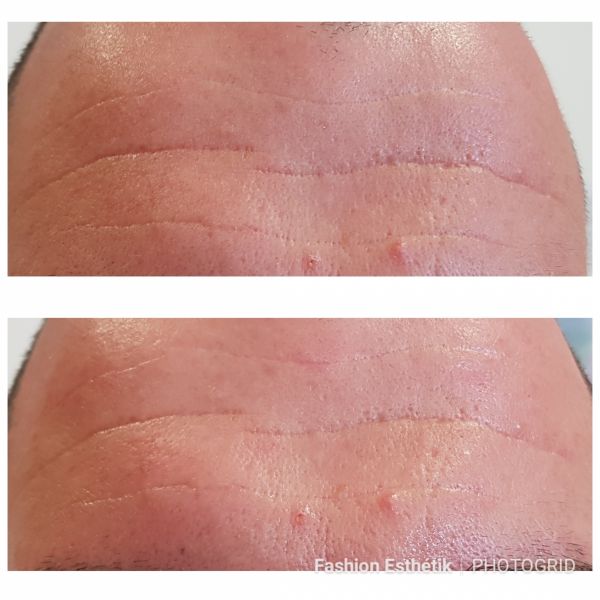  Institut de Beauté Fashion Esthetik TARBES